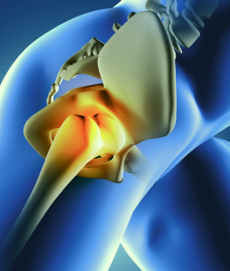 Knee Bone